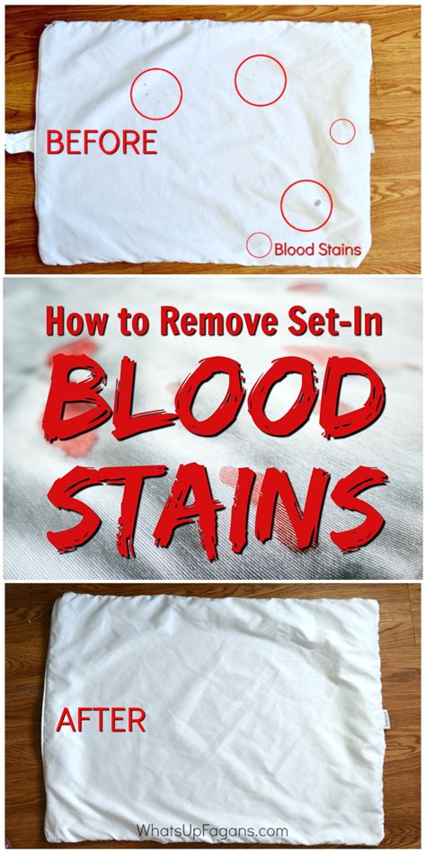 how to remove dried blood from fabric